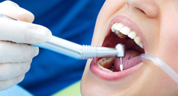 Estetik Diş Hekimliği'nde güvenilir adres Dentadent
